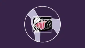 patrón pulmonar en radiografía