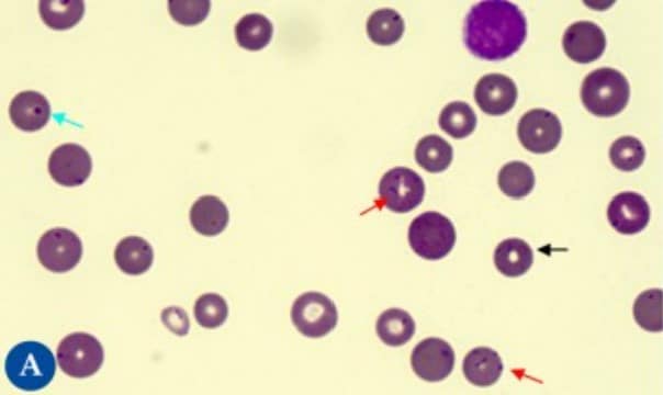 Micoplasmas hemotópicos