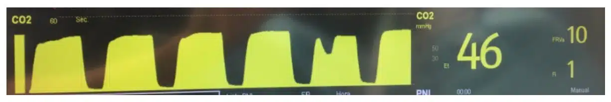 Medición de niveles de Co2
