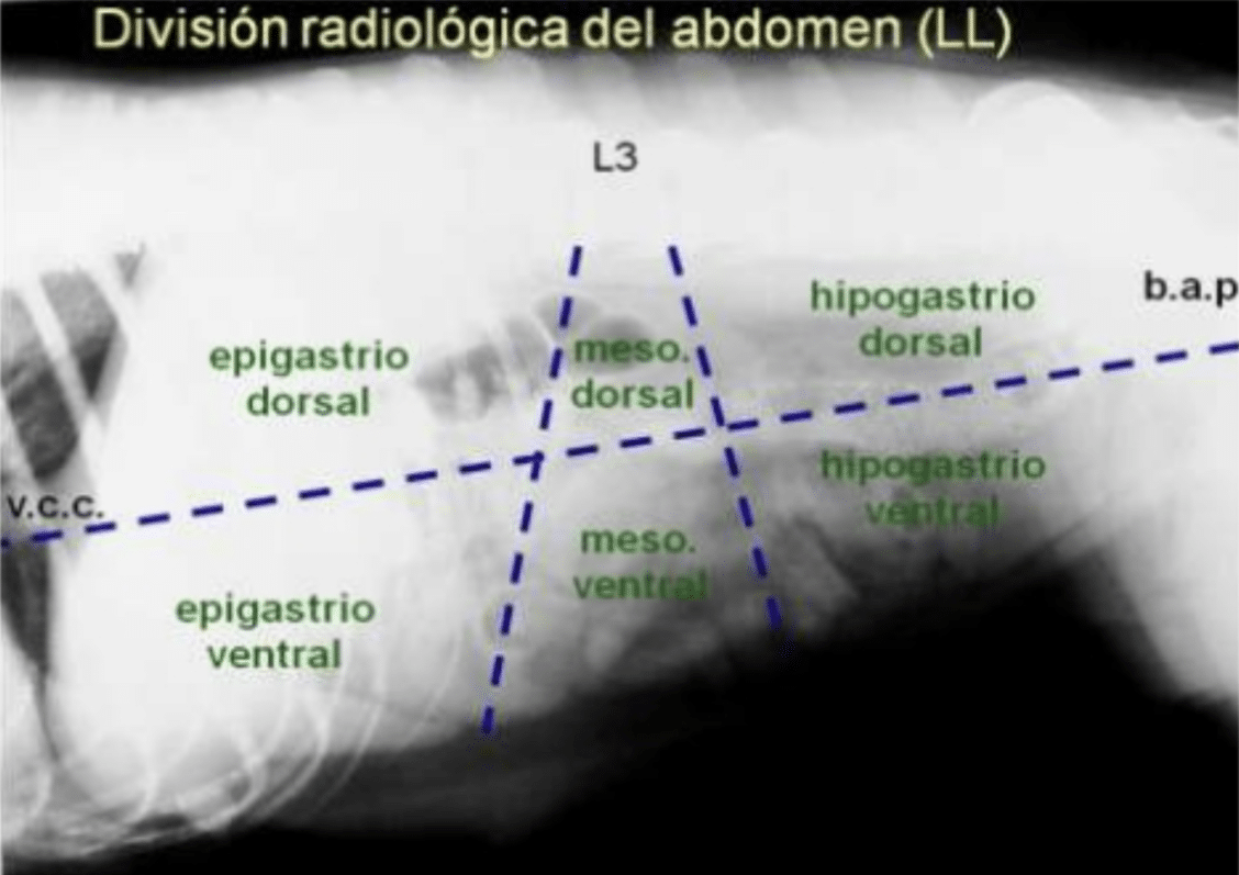 radiografía división abdomen