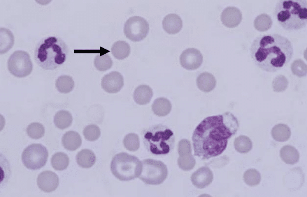anemia hemolitica inmunomediada en perros.