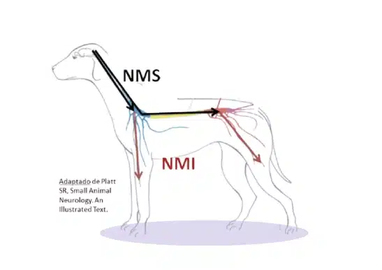 Afectación de la neurona motora superior vs neurona motora inferior